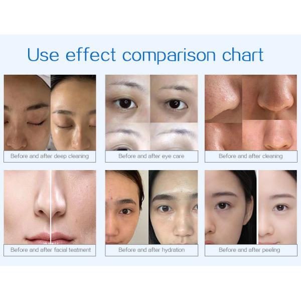 Professional Spa 14in1 Korean Hydra Dermabrasion Facial Machine Hydro H2o2 Bubble Microdermabrasion Facial Machine