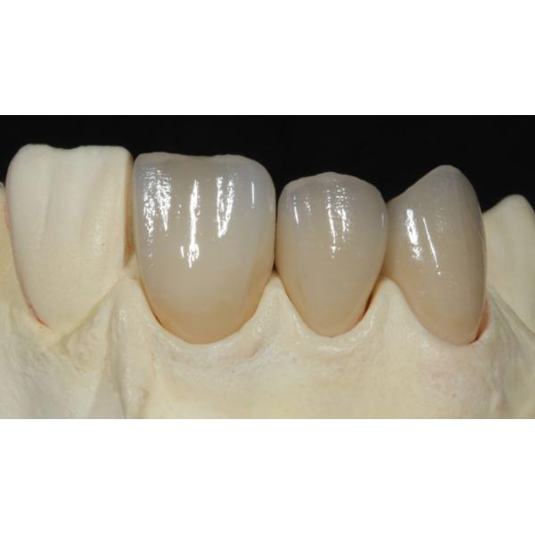 C2 Dental Milling Zirconium Oxide Ceramic CAD CAM 25mm Thickness