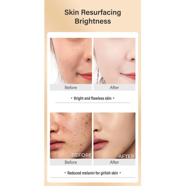 50ml Turmeric Repair Cream Anti Acne Anti Aging Anti Wrinkles Whitening Soothing