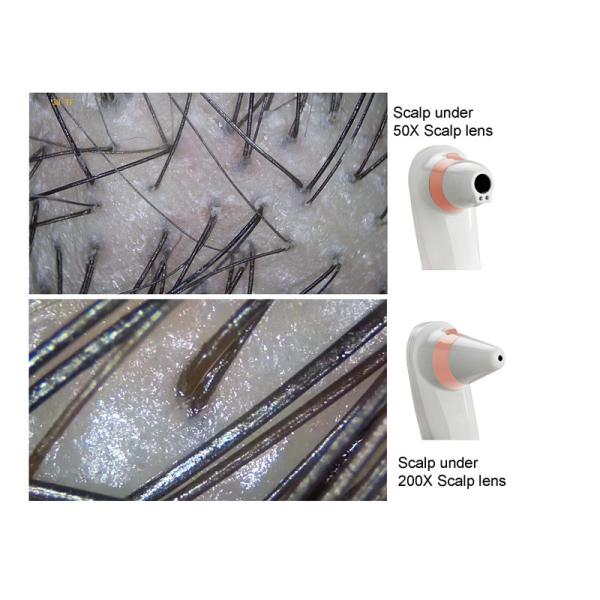 Анализатор кожи машины анализатора здоровья цифровых фотокамер машины анализатора здоровья китайский