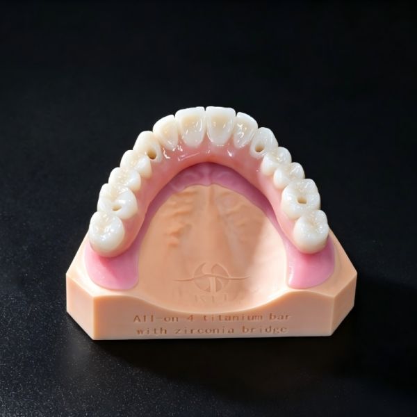 ALL On  X Implant Zirconia Bridge Implant Crown Bridge Natural Appearance