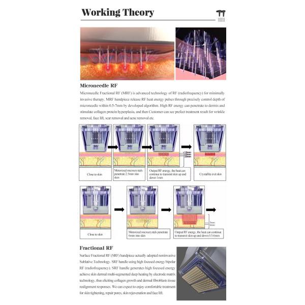 Appareil de rajeunissement de la peau par radiofréquence Équipement de lifting du visage non chirurgical AC220V 110V