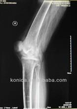 Imagem latente diagnóstica durável de X Ray, filme azul de X Ray do laser do papel médico de 32cm x de 43cm