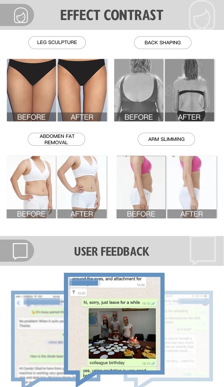 Двухполярные 4 ручки bodyshape уменьшая подниматься кожи радиочастоты машины