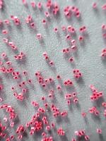 Médias de soufflage en plastique à haute stabilité thermique 0,40 mm pour les composants en plastique moulé
