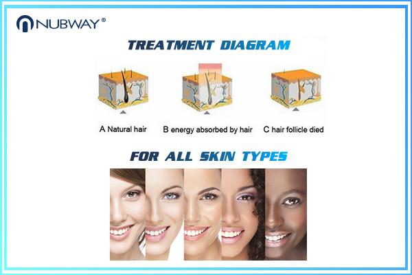 10 Laser bars  Strong Power 808nm Diode Laser Hair Removal Machine
