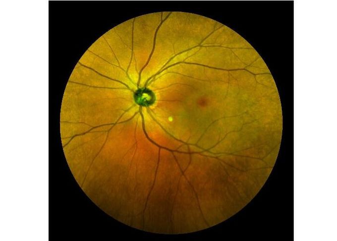Оборудование камеры Fundus сканирования лазера профессиональное офтальмическое с Fundus отображая размер зрачка FOV 160° минимальный 2 mm