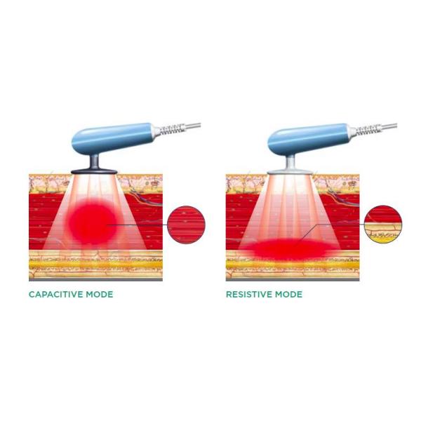 Tecar 7.0 RET RF Body Slimming Tecar Therapy Machine