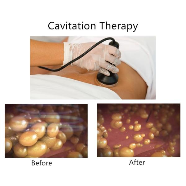 машина радиочастоты 40KHz для мышцы простирания жесткой/активирует ткань коллагена