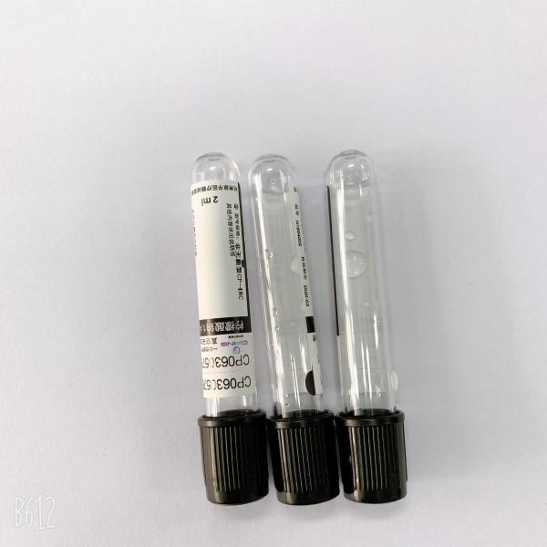 全血のヨーロッパの腎臓連合のための2ml ESRの管のOdiumのクエン酸塩の1:4