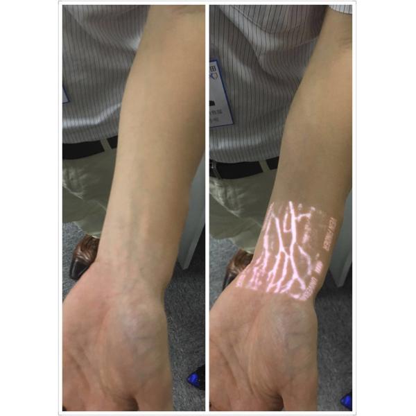 Medical Vein Locator Device / Vein Viewer Device For Emergency , No Laser And No Radiation