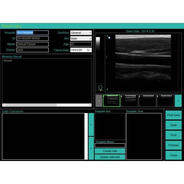 High Resolution Laptop B/W Ultrasound MSK Ultrasound Scanner Laptop Ultrasound Machine