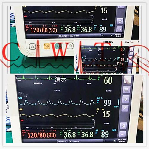 PHiliph Efficia CM10 usou o equipamento médico de monitor paciente garantia de 90 dias