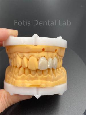 High Durability Multilayered Zirconia Dental Ceramics For Dental Lab Medical Product