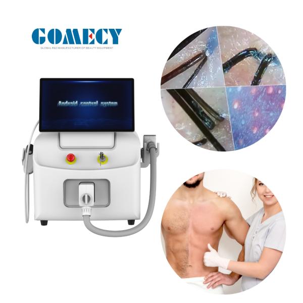 2025 AI Skin Analyzer 4 Wavelength Diode Laser Hair Removal Machine 755nm 808nm 940nm 1064nm Painless Permanent