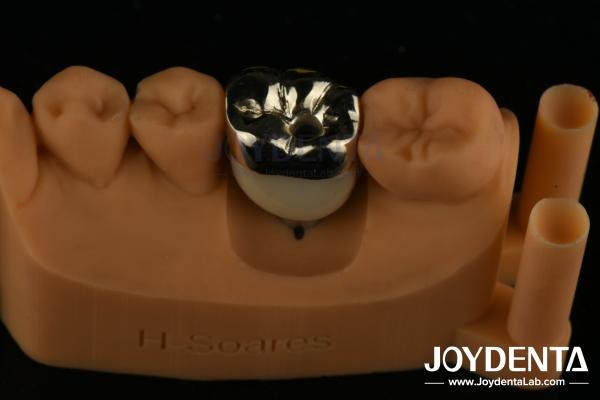 Oral Rehabilitation Wax Casting FMC Full Metal Crown For Dental Clinical Repair