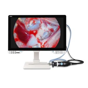 Sistema de cámara de endoscopia todo en uno 4K TUYOU Medical con fuente de luz y monitor para cirugía laparoscópica