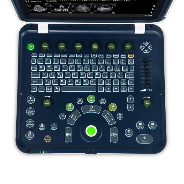 Color Doppler Portable Ultrasound Machine Medical USG PW CW DICOM Cardiac Probe Cardiology for Hospital Clinic