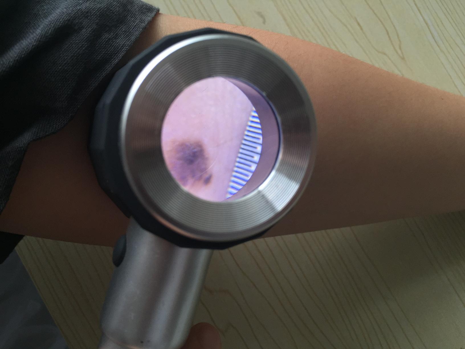 Анализатора кожи 3 СИД микроскоп Lcd портативного Dermatoscope Handheld