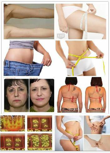 Cuerpo del Rf del vacío del ultrasonido que adelgaza la máquina 40khz de la belleza de la cavitación de la máquina
