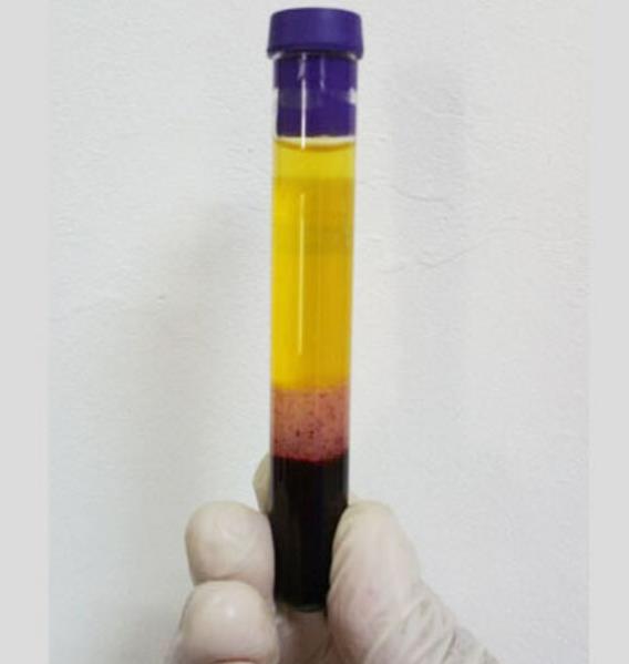 Best Price CenLee 10ml GLASS/PET Separation Tubes with ACD Gel & Biotin Multi-Color 50pcs/bag 1 Year Warranty