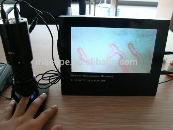 Dispositivo capilar do microscópio do Microcirculation do Nailfold exato do LCD da cor para a verificação secundária da saúde