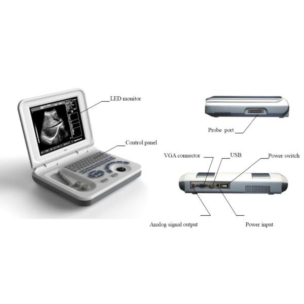10.4'' LED Display Portable Ultrasound Scanner For Women Pregnancy Examination