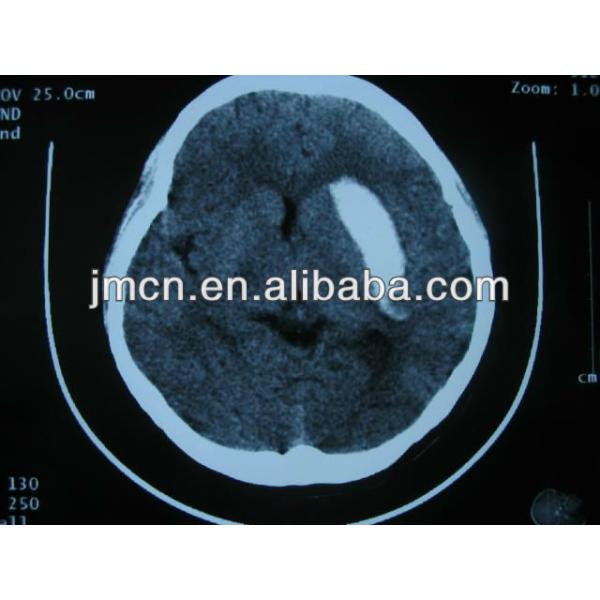 Double Layer DT2B Medical Dry Film X Ray For Agfa Thermal Printer