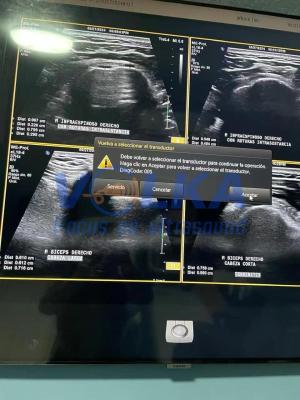Repair ATL Original Ultrasound Probe EL18-4 Showing Error 005