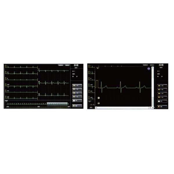 Ecg Machine 18 Channel Wifi Ecg Machine For Icu Hospital