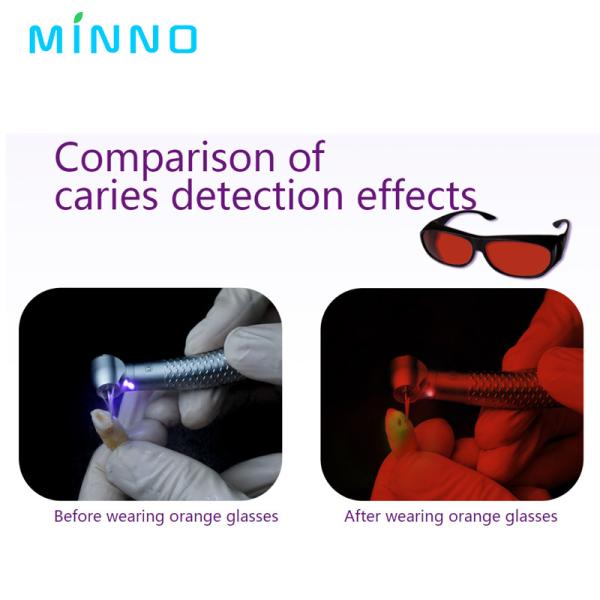 Caries Detection Dental High Speed Handpiece 280000rpm Push Button Handpiece