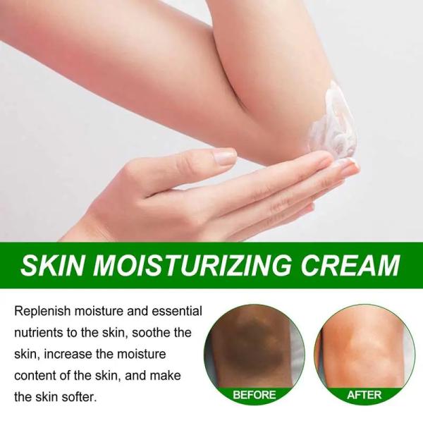 Creme de clareamento corporal soro de branqueamento remover a pigmentação da melanina clarear a pele da coxa interna creme hidratante