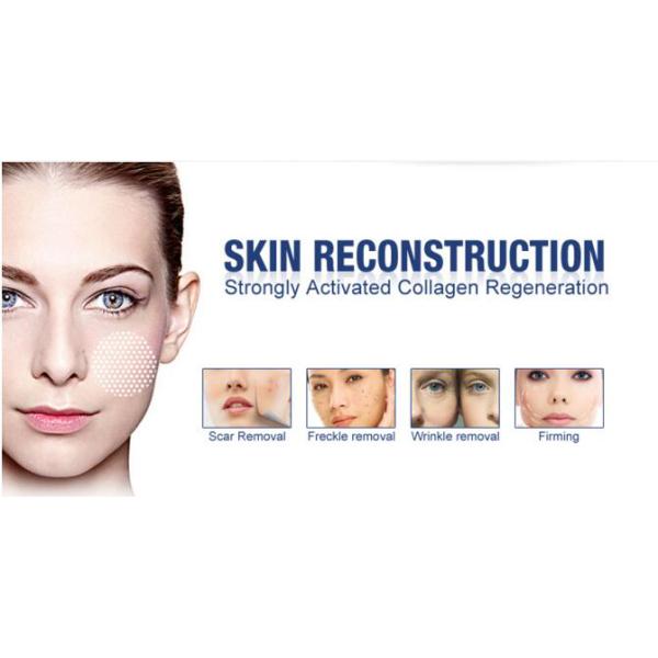 10600nm Ultra Pulse Co2 Fractional Laser Tightening Device With Wind Cooling