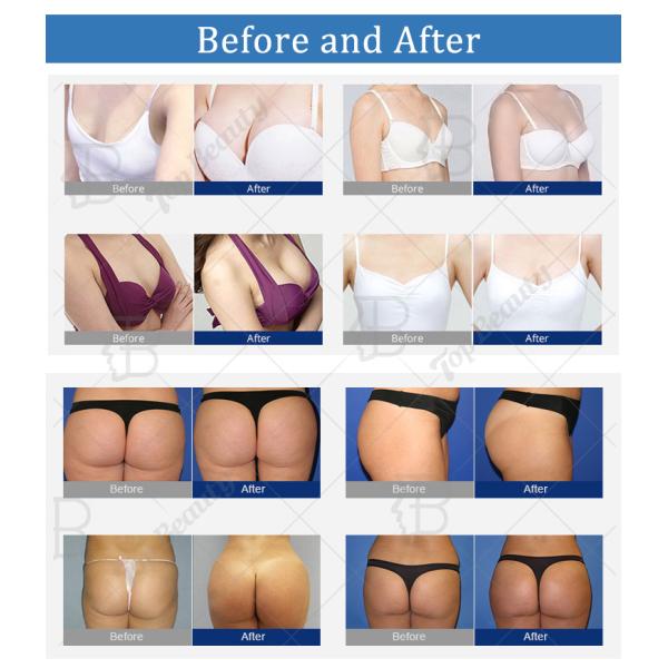 Профессиональный вакуумный подъемник для задниц