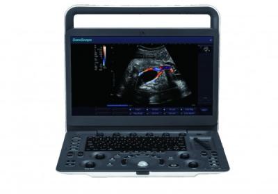 7 Imaging Levels SonoScape E3 Portable Ultrasound Machine With 15.6 Inch Monitor