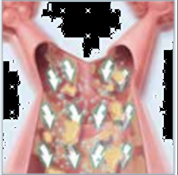 Portable Healthcare Vest Airway Clearance System Devices 220V