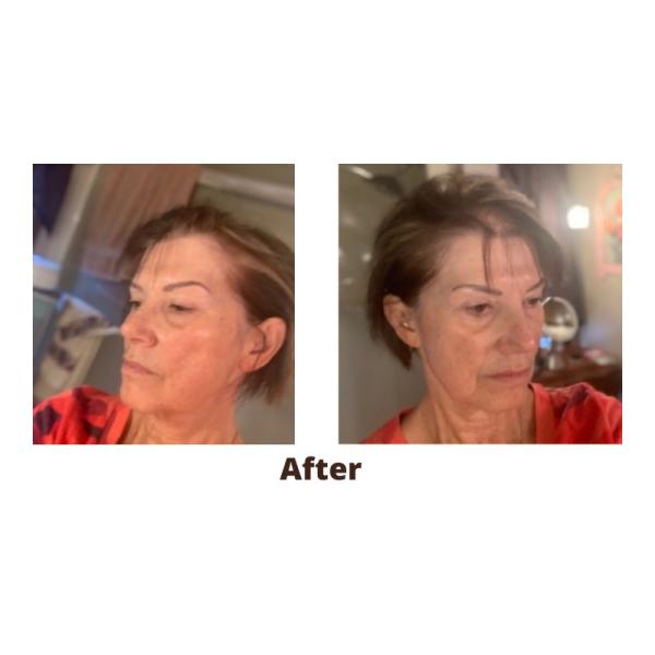 650nm Anti Hair Fall Helmet