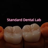 Laboratorio Dental de Bruxier de contorno completo de zircónia monolítica de Crown Bridge