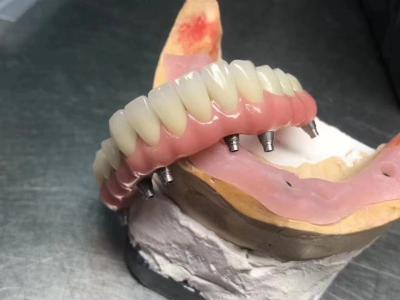 High Translucency Solid  Implant Supported Crown Customizable For Dental Restoration