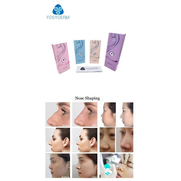 enchimento cutâneo do nariz cirúrgico hialurónico do Rhinoplasty do gel 2ml