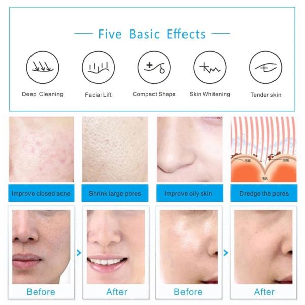 6 In 1 Photon Light Therapy Machine PDT Hydrafacial Care Beauty Device