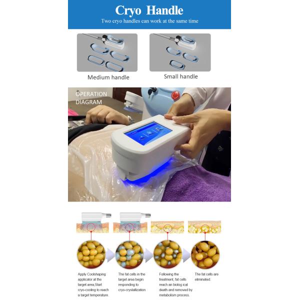 Vacuum Anti Cellulite RF Weight Loss Equipment Slimming Machine Weight Loss