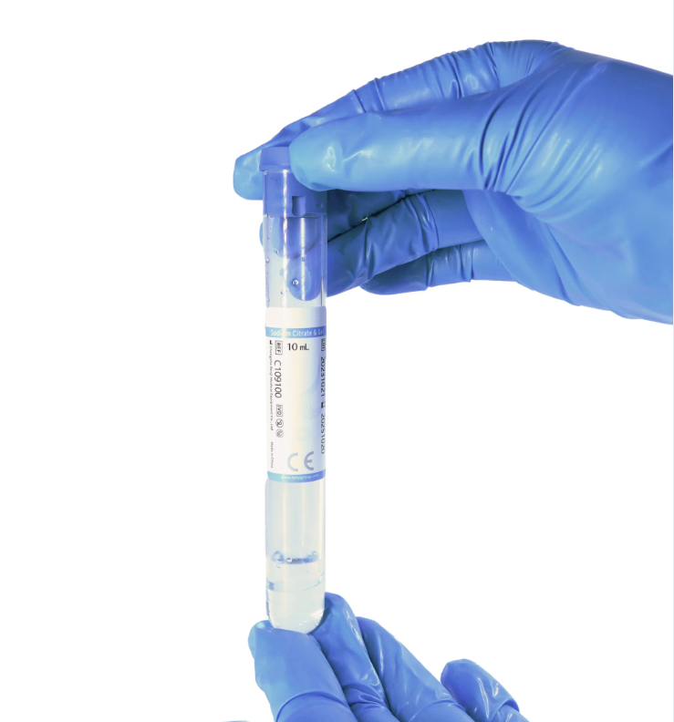 8ml 10ml Medical Platelet Rich Plasma Tube with Acd Gel Biotin Test Tubes