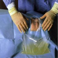 Le polypropylène 100% a stérilisé chirurgical jetable drapent pour l'ophthalmologie