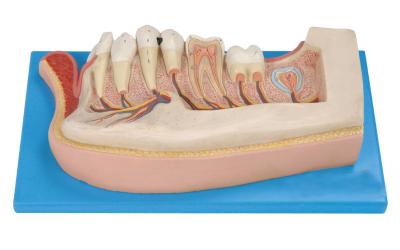 Human Teeth Model , 21 Positions are Displayed of Mandibular Permanent Teeth about  Child
