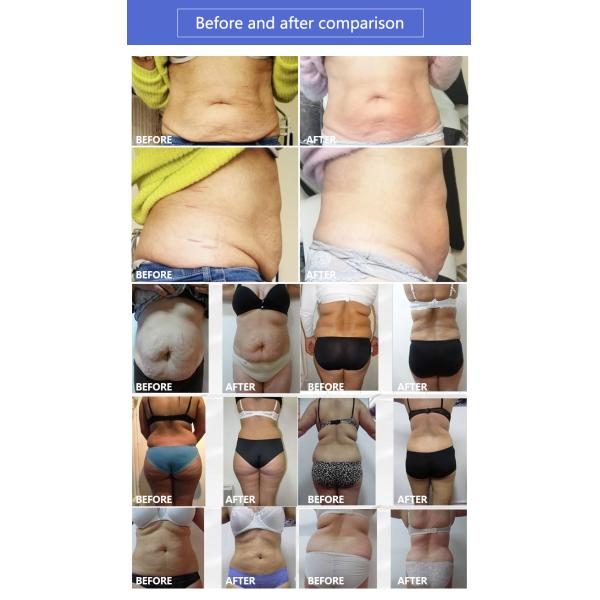 LF-1032a infrared pressotherapy machinery/body pressure therapy/pressotherapy device