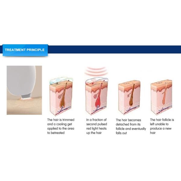 2018 hot selling big spot size 808nm diode laser hair removal system machine