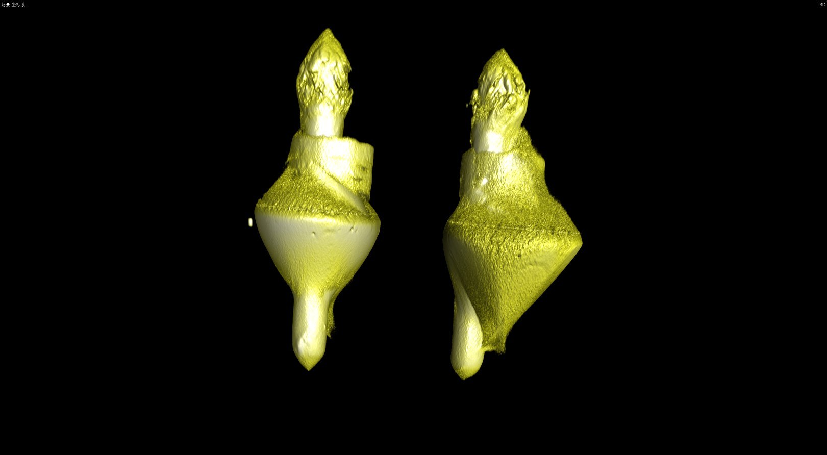 High Resolution 3D CT Imaging For PCBA PTH Capacitor UNICOMP AX9100VS X-ray Inspection