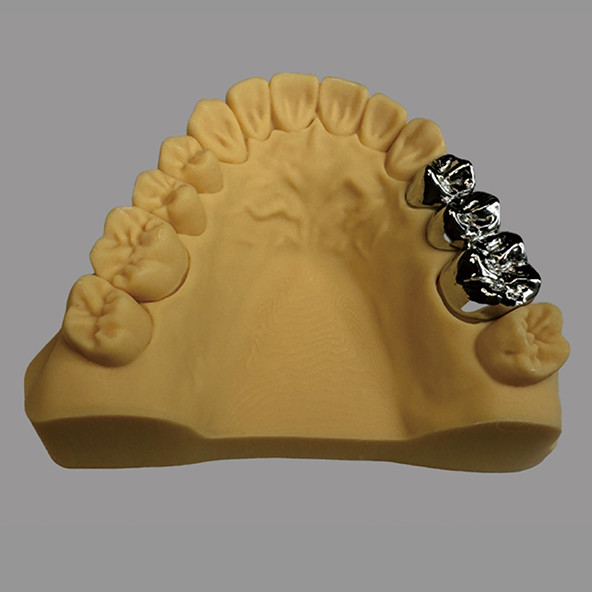 CoCr Full Metal Crown And Bridge Smooth Polished Customizable