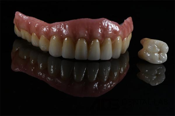 Titanium Zirconia Implant Supported Dental Bridge All On 4 6